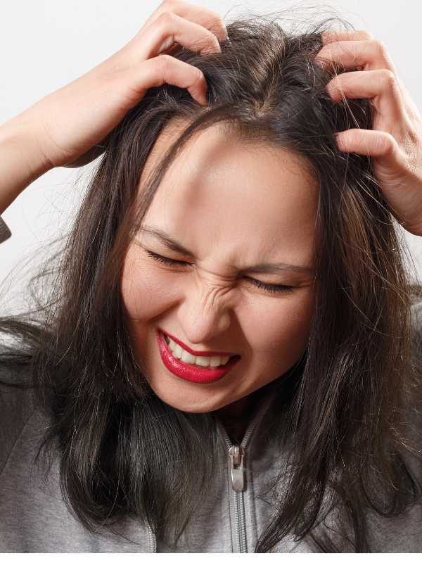 How to Get Rid of Dandruff at Home